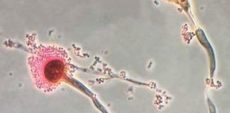 Study: Chemists characterize the fatal fungus among us — (Details)