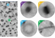 Tech: Eagle-eyed machine learning algorithm outdoes human experts — (Report)