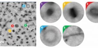 Tech: Eagle-eyed machine learning algorithm outdoes human experts — (Report)