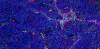 Study: Giant neurons in the brain may play similarly giant role in awareness and cognition — (Details)