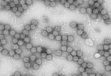 Research: Intestinal virus study shows major changes associated with inflammatory bowel disease —