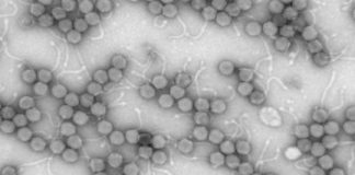 Research: Intestinal virus study shows major changes associated with inflammatory bowel disease —