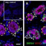 Study: Treatments for cancer and sickle cell disease deplete germ cells in young boys — (Details)
