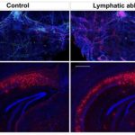 Study: Faulty brain plumbing to blame in Alzheimer’s, age-related memory loss — and can be fixed — (Details)