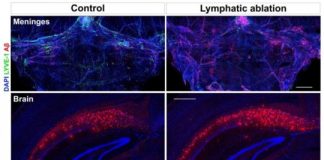 Study: Faulty brain plumbing to blame in Alzheimer’s, age-related memory loss — and can be fixed — (Details)