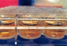 Research: Researchers generate missing cell type in brain ‘organoids’ —