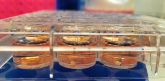 Research: Researchers generate missing cell type in brain ‘organoids’ —