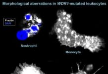 Research: Crucial factor for adaptive immunity discovered in rare disease —