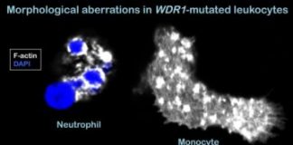 Research: Crucial factor for adaptive immunity discovered in rare disease —