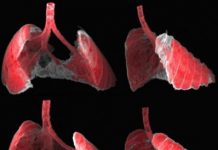 Tech: Nano-carrier releases drugs into damaged cells — (Report)