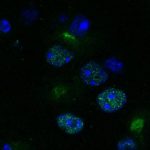 Study: New system can identify drugs to target ‘undruggable’ enzymes critical in many diseases — (Details)