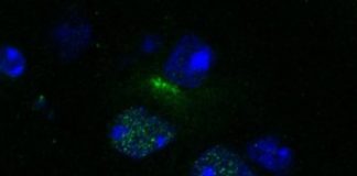 Study: New system can identify drugs to target ‘undruggable’ enzymes critical in many diseases — (Details)