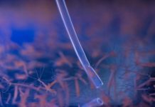 Research: Squishy hydra’s simple circuits ready for their close-up —