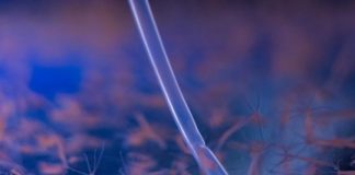 Research: Squishy hydra’s simple circuits ready for their close-up —