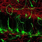 Study: Can scientists leverage mysterious mossy cells for brain disease treatments? — (Details)