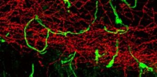 Study: Can scientists leverage mysterious mossy cells for brain disease treatments? — (Details)