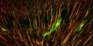 Study: Leopard geckos can make new brain cells — (Details)