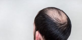 Research: The research advances search for compounds that may someday accelerate wound healing and reverse balding —