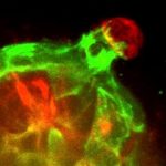 Study: Scientists discover a dynamic cellular defense against breast cancer invasion — (Details)