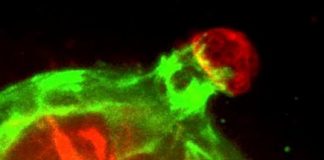 Study: Scientists discover a dynamic cellular defense against breast cancer invasion — (Details)