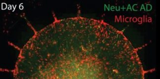 Study: System fully replicates Alzheimer’s pathology, including neural cell death — (Details)