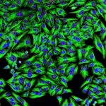 Study: New cell lines produce monoclonal antibody for improved biologic drugs — (Details)