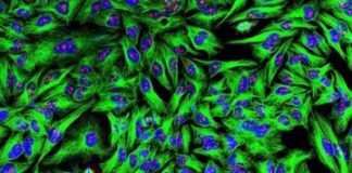 Study: New cell lines produce monoclonal antibody for improved biologic drugs — (Details)