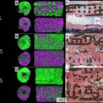 Study: 3D-Printed implants shown to help grow ‘real bone’ — (Details)