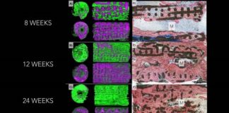 Study: 3D-Printed implants shown to help grow ‘real bone’ — (Details)