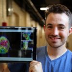 Study: AI tool automates radiation therapy planning — (Details)