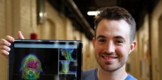 Study: AI tool automates radiation therapy planning — (Details)