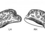 Study: Child’s lobectomy reveals brain’s ability to reorganize its visual system — (Details)