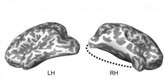 Study: Child’s lobectomy reveals brain’s ability to reorganize its visual system — (Details)