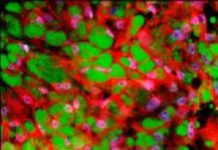 Research: Bioengineers develop a simple tissue-grafting approach to increase brown fat mass in the body and study its effect on metabolism and weight —