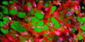 Research: Bioengineers develop a simple tissue-grafting approach to increase brown fat mass in the body and study its effect on metabolism and weight —