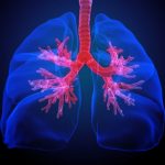Study: A previously unknown airway cell type may be a key to efforts to cure cystic fibrosis — (Details)