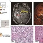 Study: Origin cells for deadly brain tumors identified — (Details)