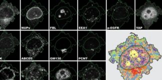 Tech: New method refines cell sample analysis — (Report)