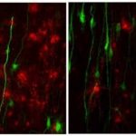 Study: Study provides insight into how to treat other neurodegenerative conditions, including Alzheimer’s disease — (Details)