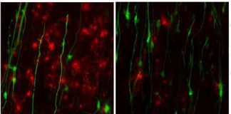 Study: Study provides insight into how to treat other neurodegenerative conditions, including Alzheimer’s disease — (Details)