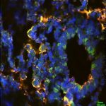 Study: Alcohol increases tuberculosis-related deaths in young mice — (Details)