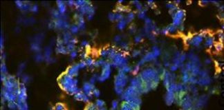 Study: Alcohol increases tuberculosis-related deaths in young mice — (Details)