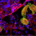 Study: Focusing on hookworms, mouse study identifies role infection-fighting cells play in inflamed and damaged tissue — (Details)