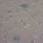 Study: Breakthrough could be ‘basis for a new generation of anti-degeneration drugs’ — (Details)