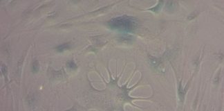 Study: Breakthrough could be ‘basis for a new generation of anti-degeneration drugs’ — (Details)