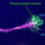 Study: How axons change chemical cues to mechanical force — (Details)