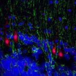 Study: Viruses can trigger psychiatric disorders, research suggests — (Details)