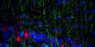 Study: Viruses can trigger psychiatric disorders, research suggests — (Details)