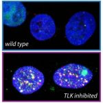 Study: Key role found for enzymes in DNA replication and sensitivity to chemotherapeutic drugs — (Details)