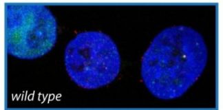 Study: Key role found for enzymes in DNA replication and sensitivity to chemotherapeutic drugs — (Details)